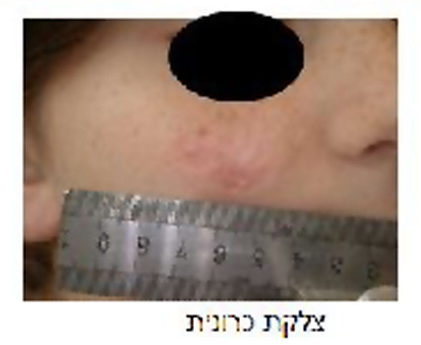 לשמניה (צילום: דוברות הדסה)