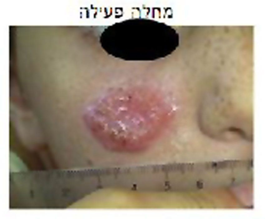 לשמניה (צילום: דוברות הדסה)