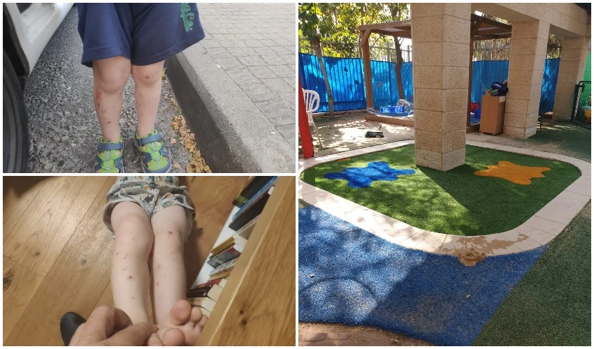 הדשא הסינתטי בגן אלה, ילדים בגן אלון שנעקצו מיתושים השבוע (צילומים: הורי גן אלון, פרטי)